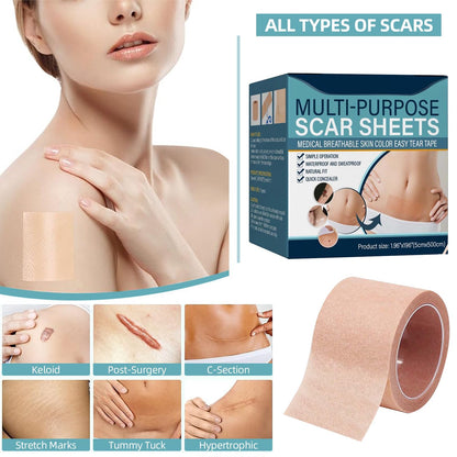 Multi-Purpose Scar Sheets Roll